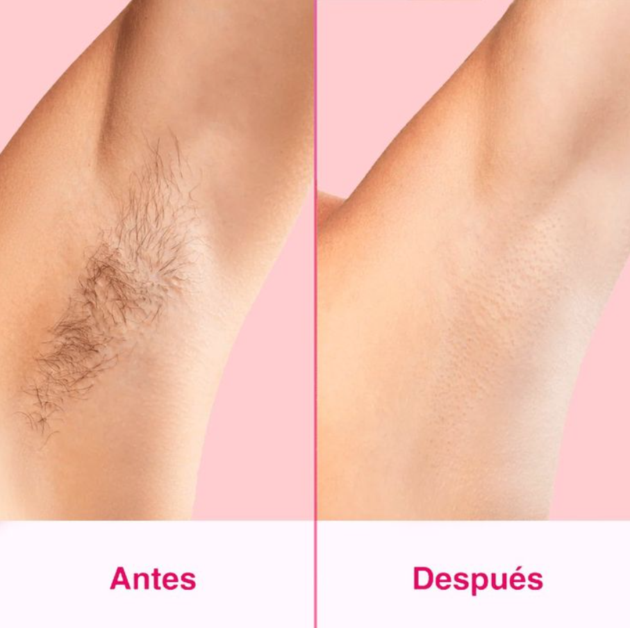 Depiladora láser IPL