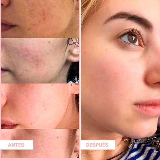 Limpieza profunda de poros Mask Stick - CLEAN MASK - COMPRE 1 LEVE 2