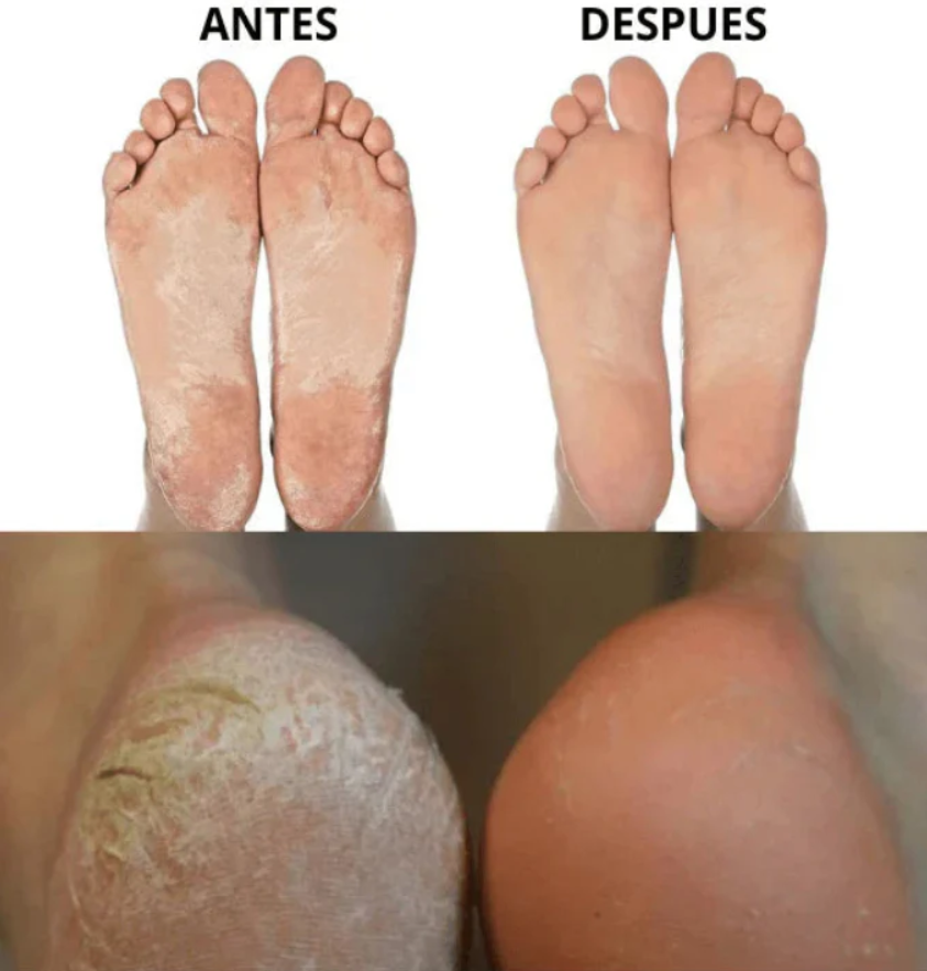 Lima de Pies Eléctrica -Foot Pro (40% DE DESCUENTO)