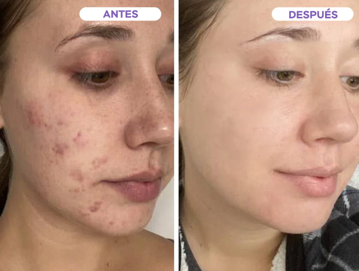 Limpieza profunda de poros Mask Stick - CLEAN MASK - COMPRE 1 LEVE 2