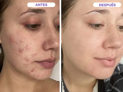 Limpieza profunda de poros Mask Stick - CLEAN MASK - COMPRE 1 LEVE 2