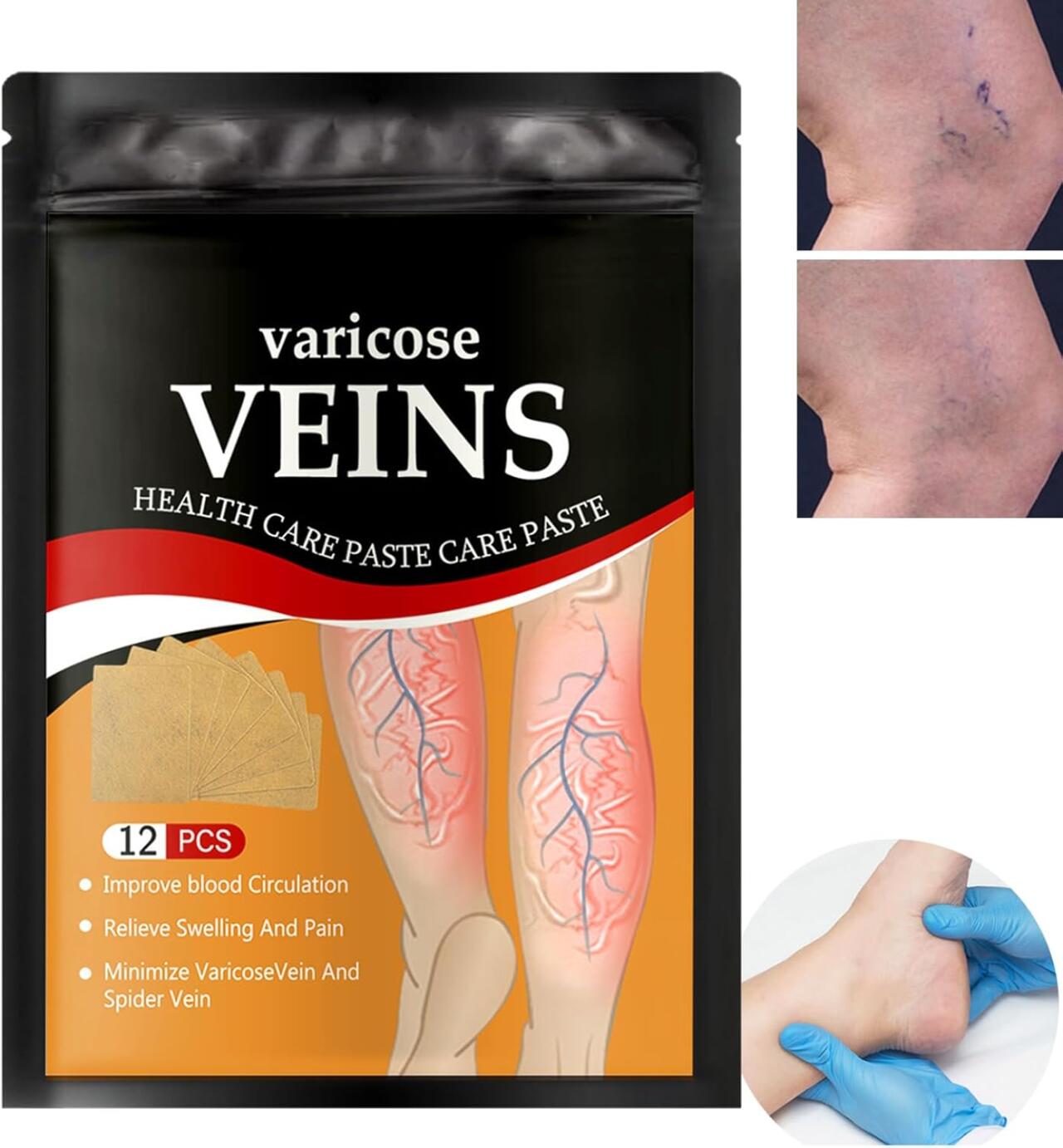 Adhesivo Anti Varices - BellaLegs